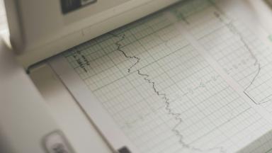 Cardiac ICU - Кардиологично интензивно отделение