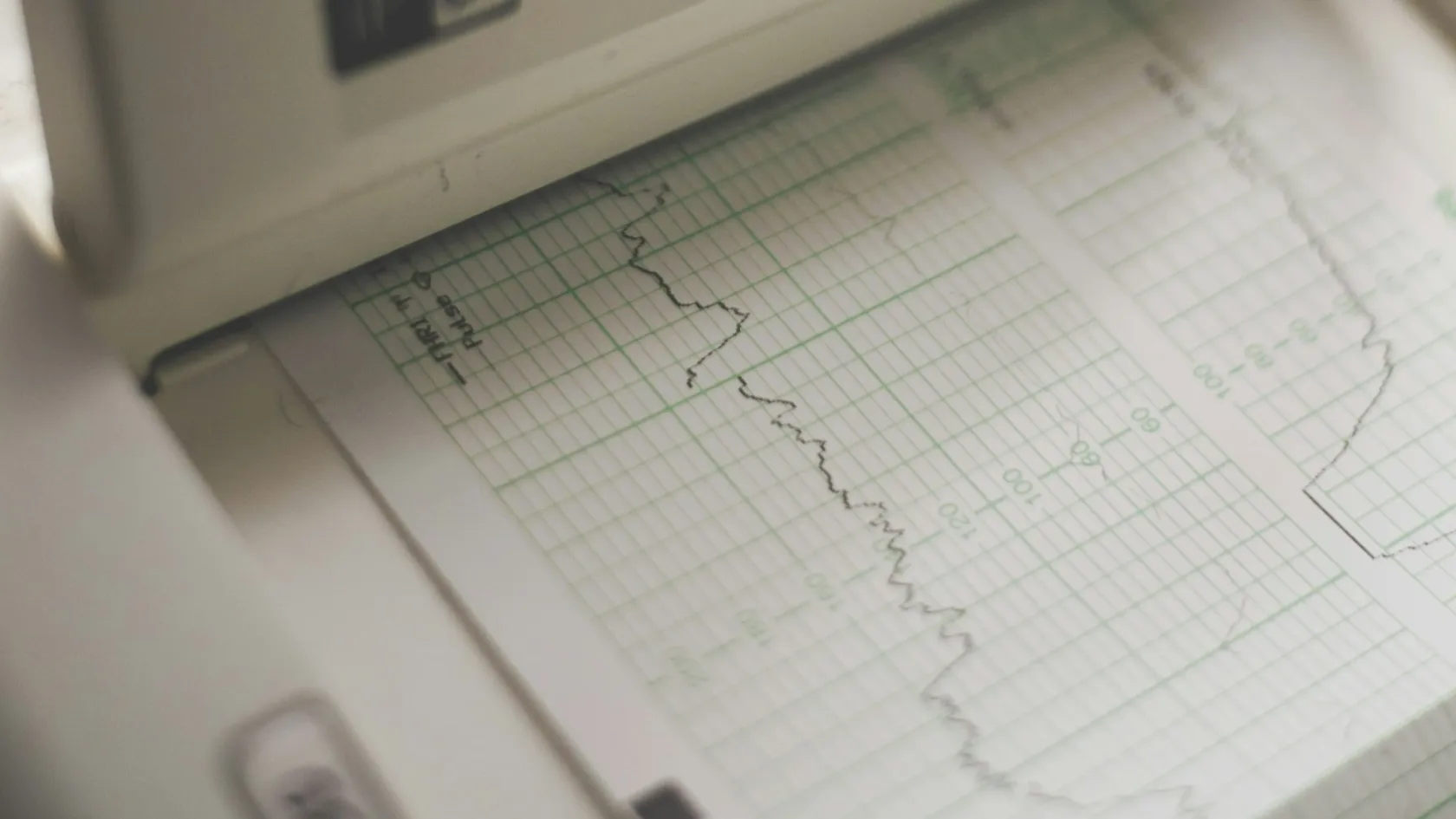 Cardiac ICU - Кардиологично интензивно отделение