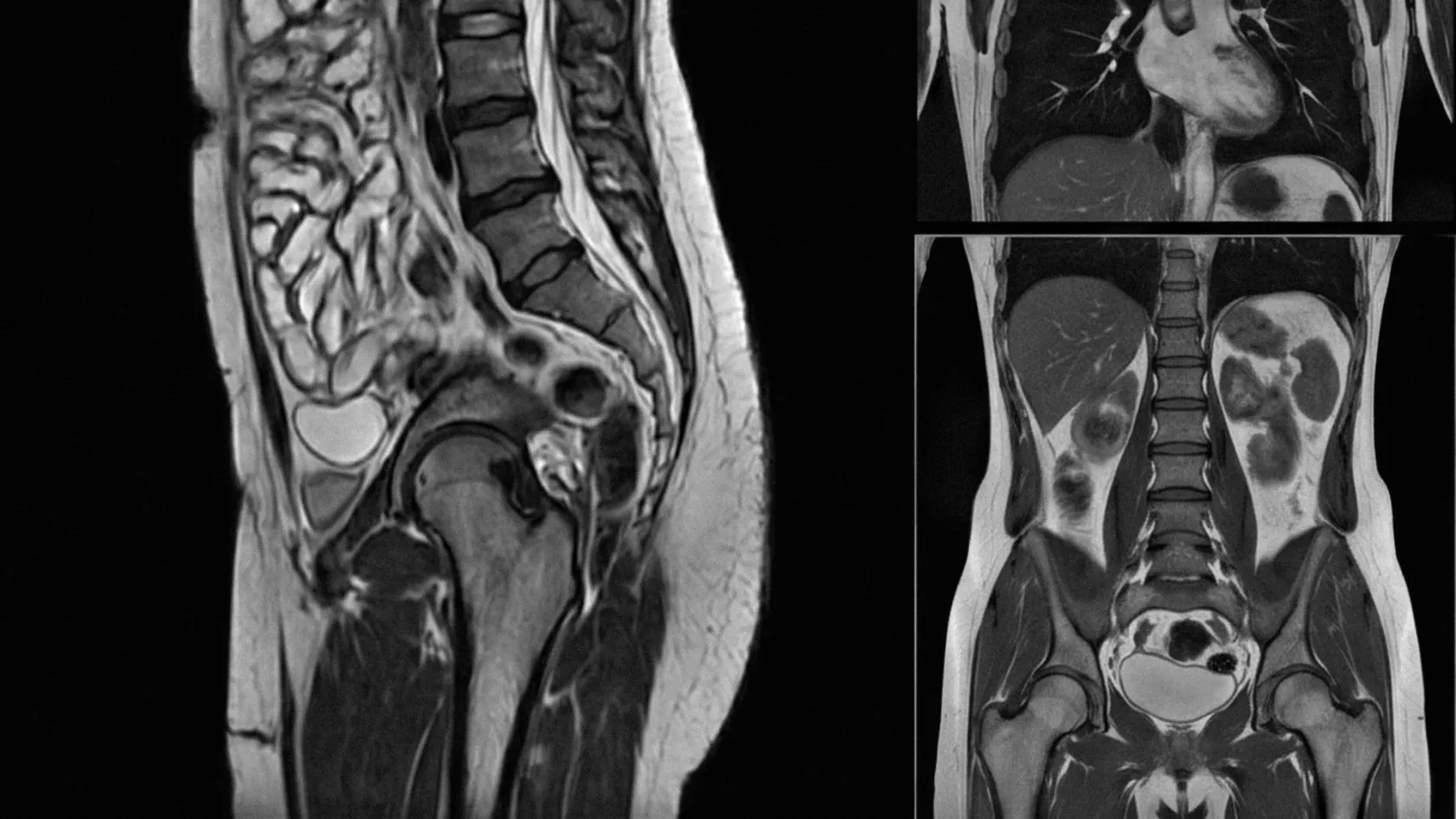 ERCP - ендоскопска ретроградна холангиопанкреатография