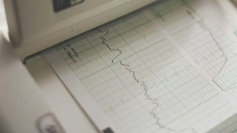 Cardiac ICU - Кардиологично интензивно отделение