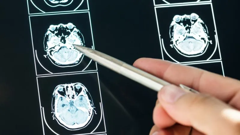 Dotatate PET/CT скенер - образна диагностика на невроендокринни тумори